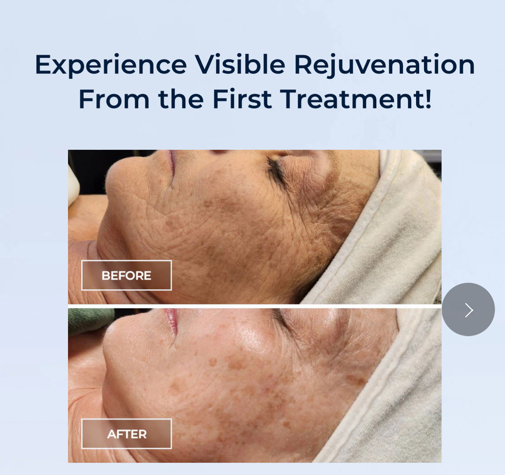 SWiCH Peel Facial at Jane Rozier Permanent Makeup & Esthetics in La Vista, NE