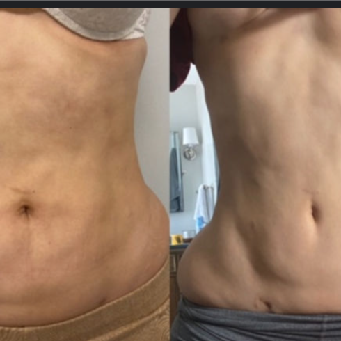 Taylor'd Fibrosis Release™