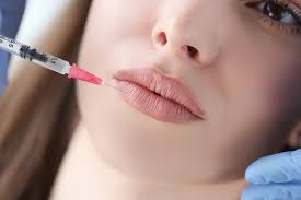 Dermal Fillers