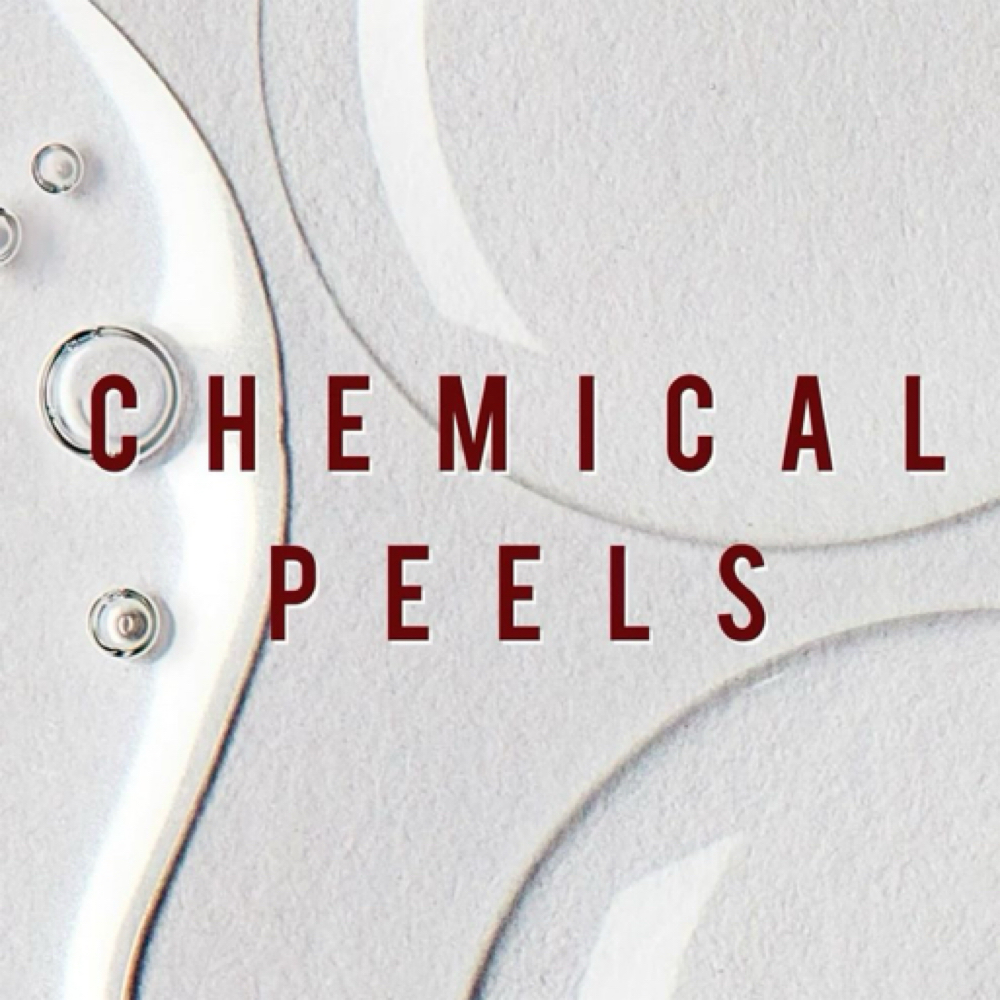 Chemical Peel Series (3 Treatments) at Skin Deep Beauty Spa in Sulphur, LA
