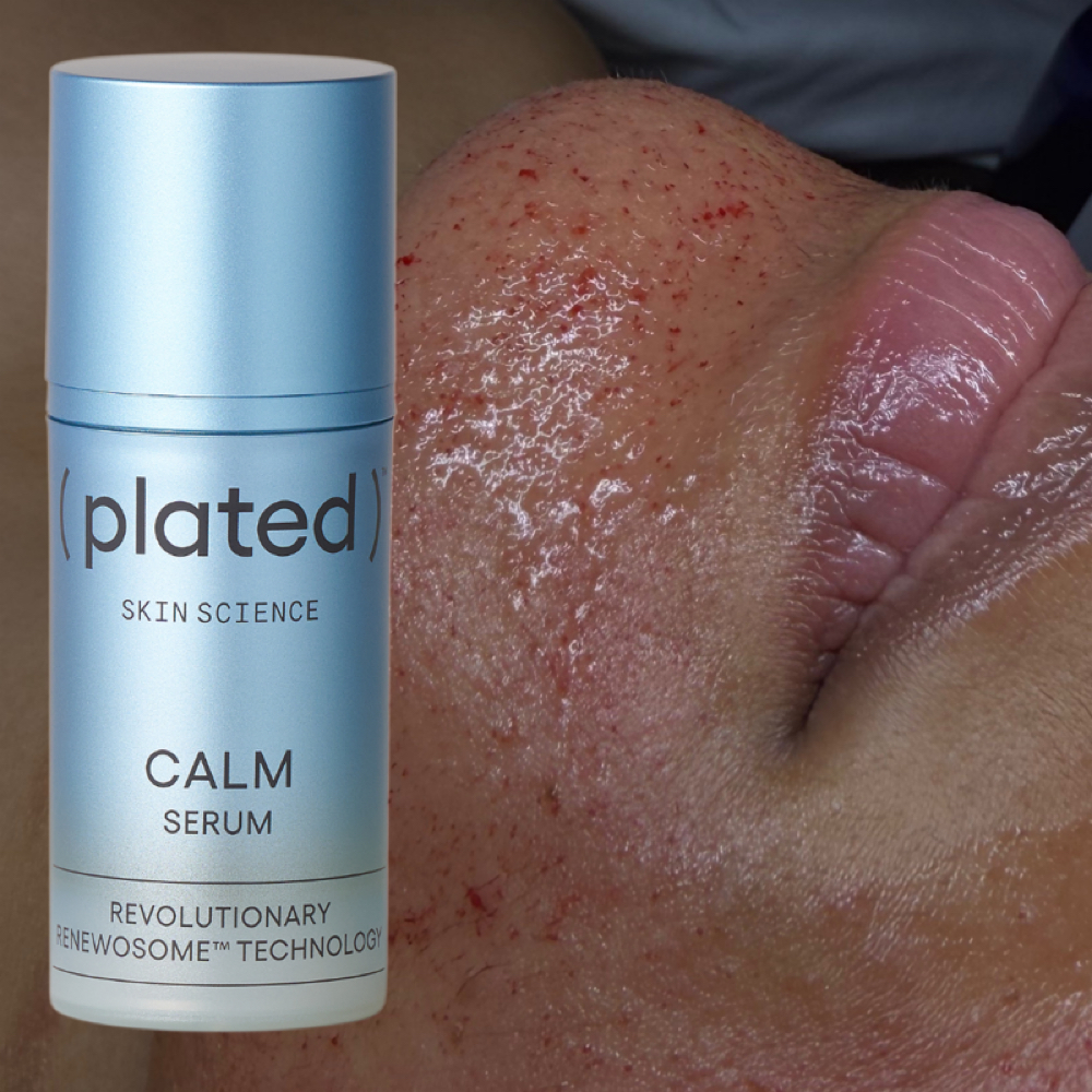 After Hours Micro-Needling at HP Skin Bar in Durham, NC