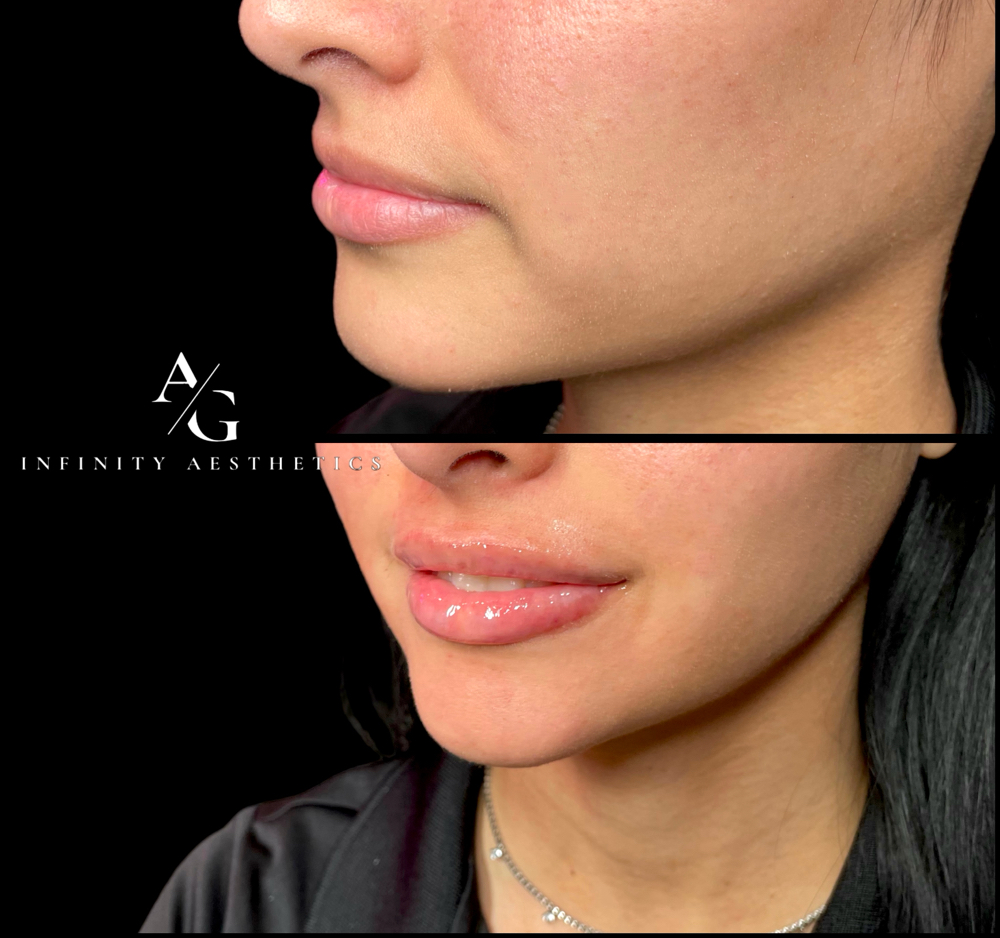 Baby Lip Plump