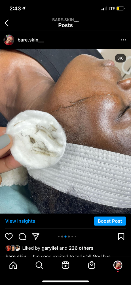 Dermaplane Facial at BareSkin in Port Allen, LA