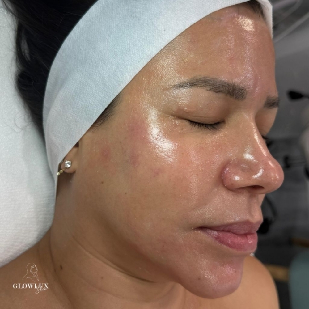 Korean Glass Skin Facial at GlowLux Skin By Claudia L in Smithtown, NY