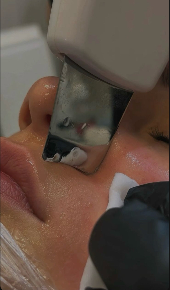 Hydrating Facial