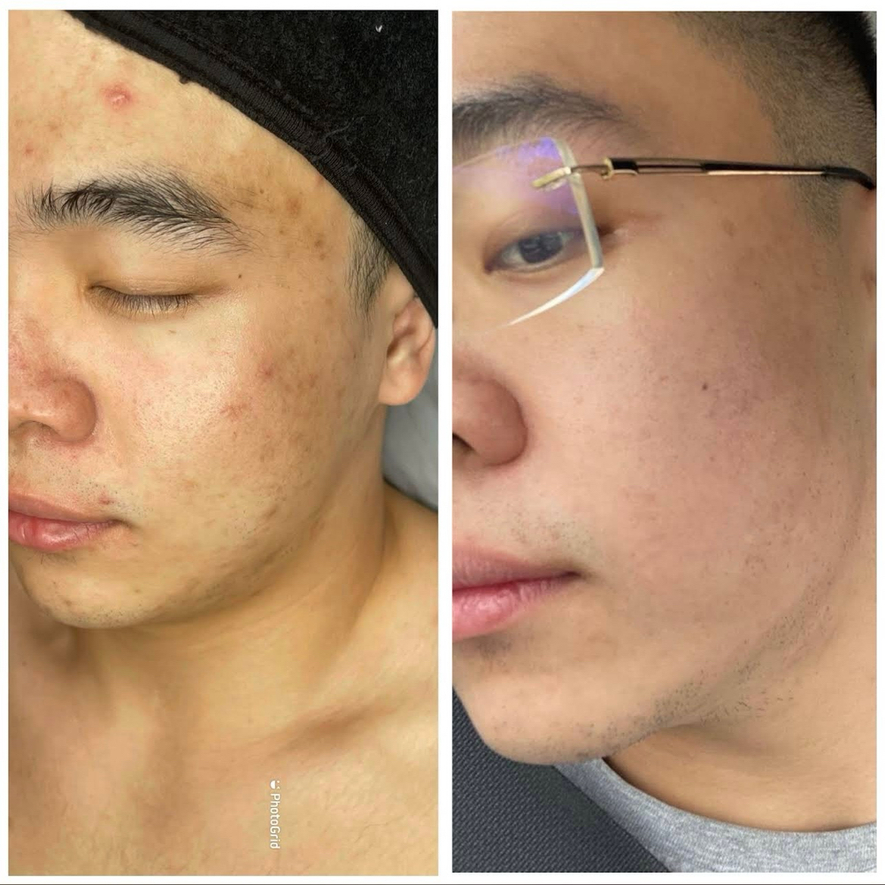 Skin Health Bundle at Clinical Complexions in Merrillville, IN