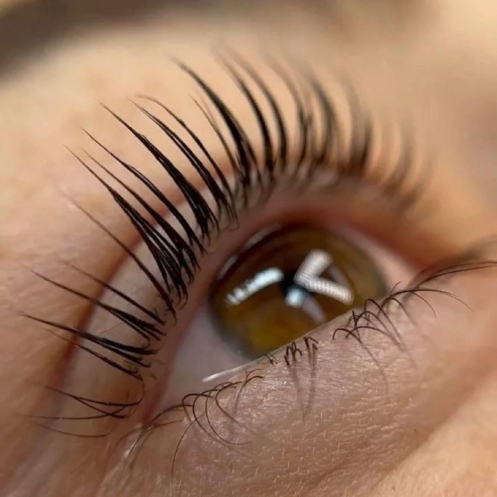 The RealEyes Lift at RealEyes Aesthetics in Los Angeles, CA