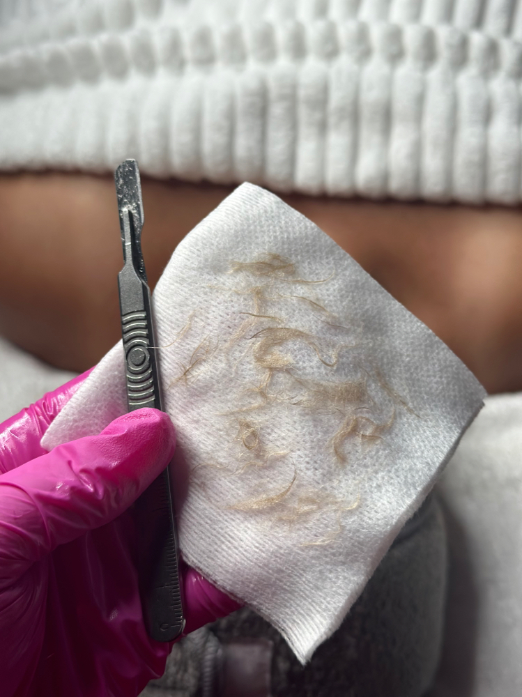 Dermaplaning Add-On