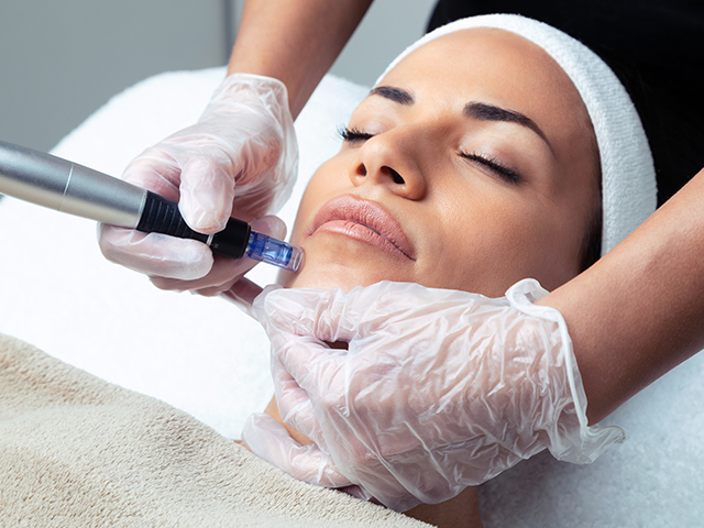 Microneedling Treatment