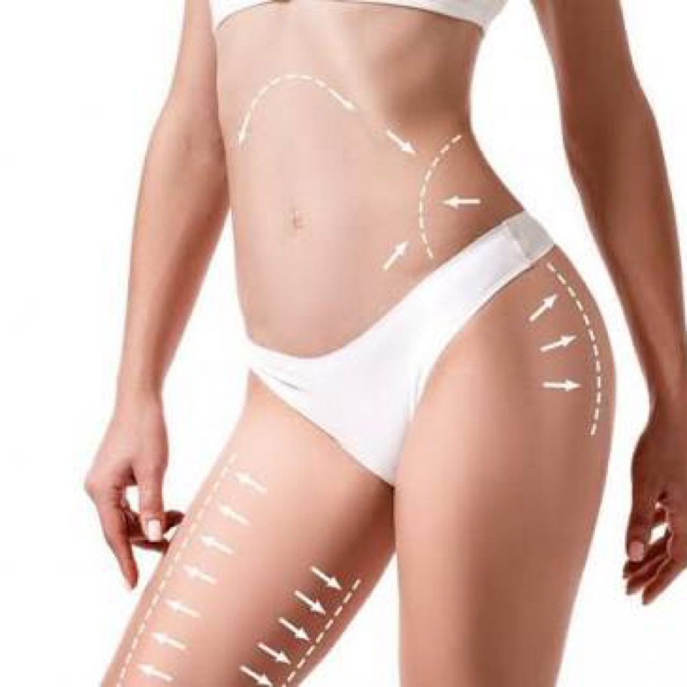 Body Sculpting Session at Sculpting Beauty by Pam LLC in Atascocita, TX