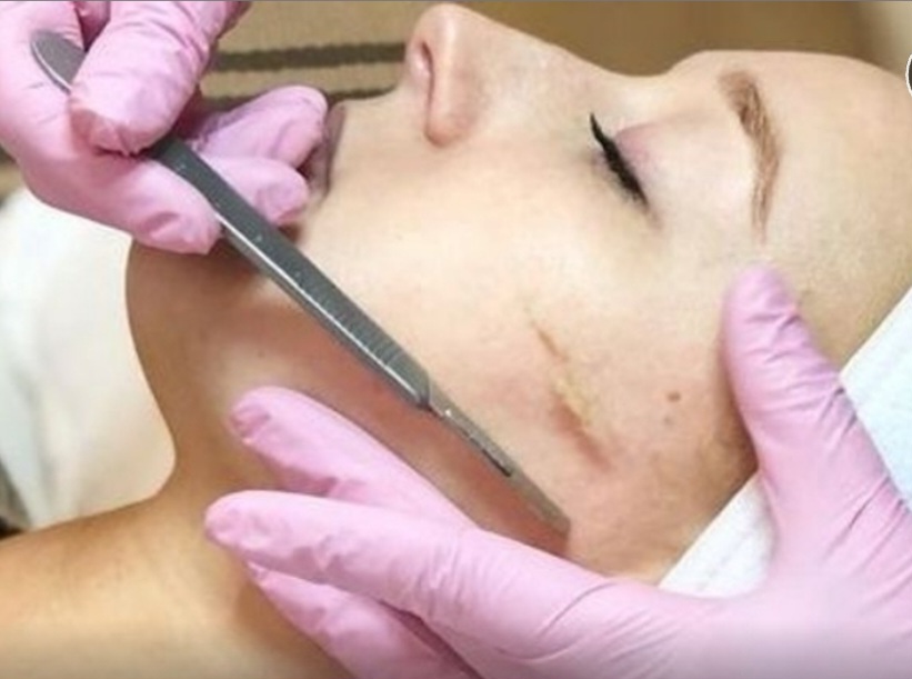 Dermaplaning at Eve's Ombre Brow's in Kissimmee, FL
