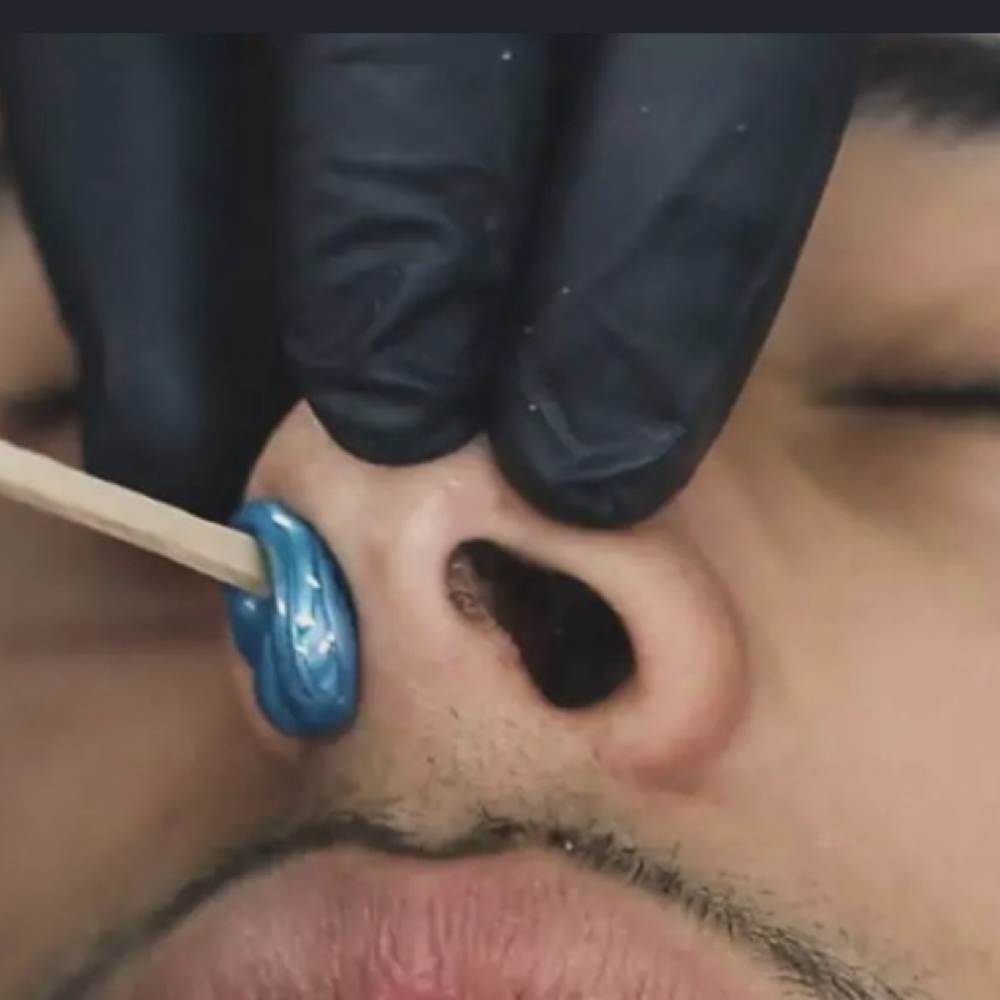 Nose Wax at Prestige Aesthetics KC in Independence, MO