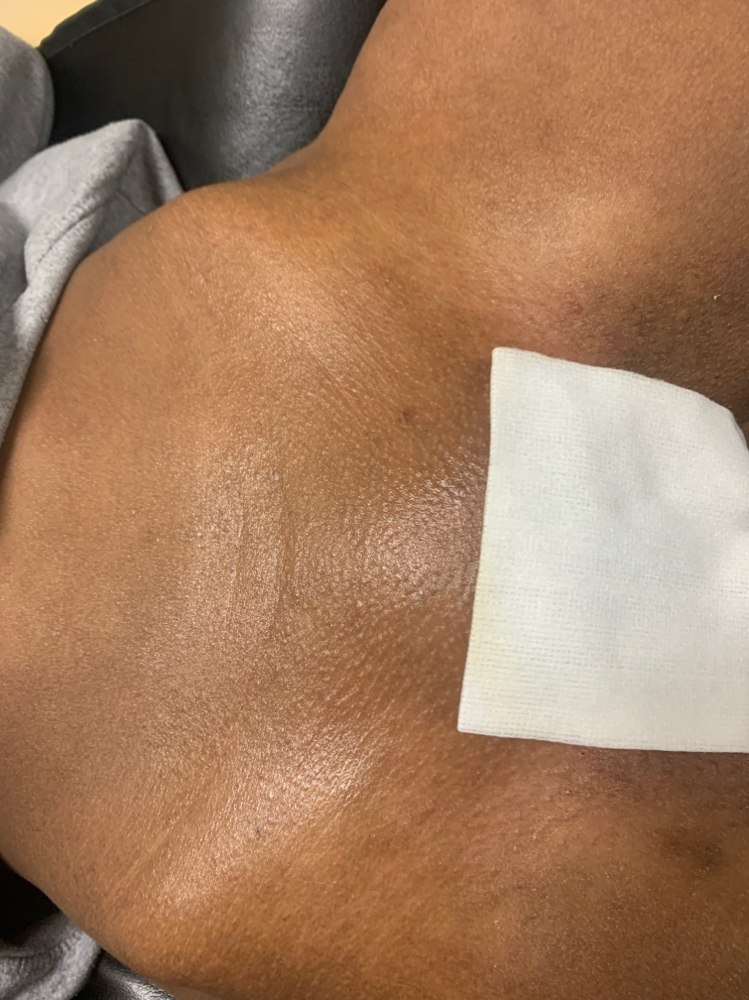 Brazilian Wax