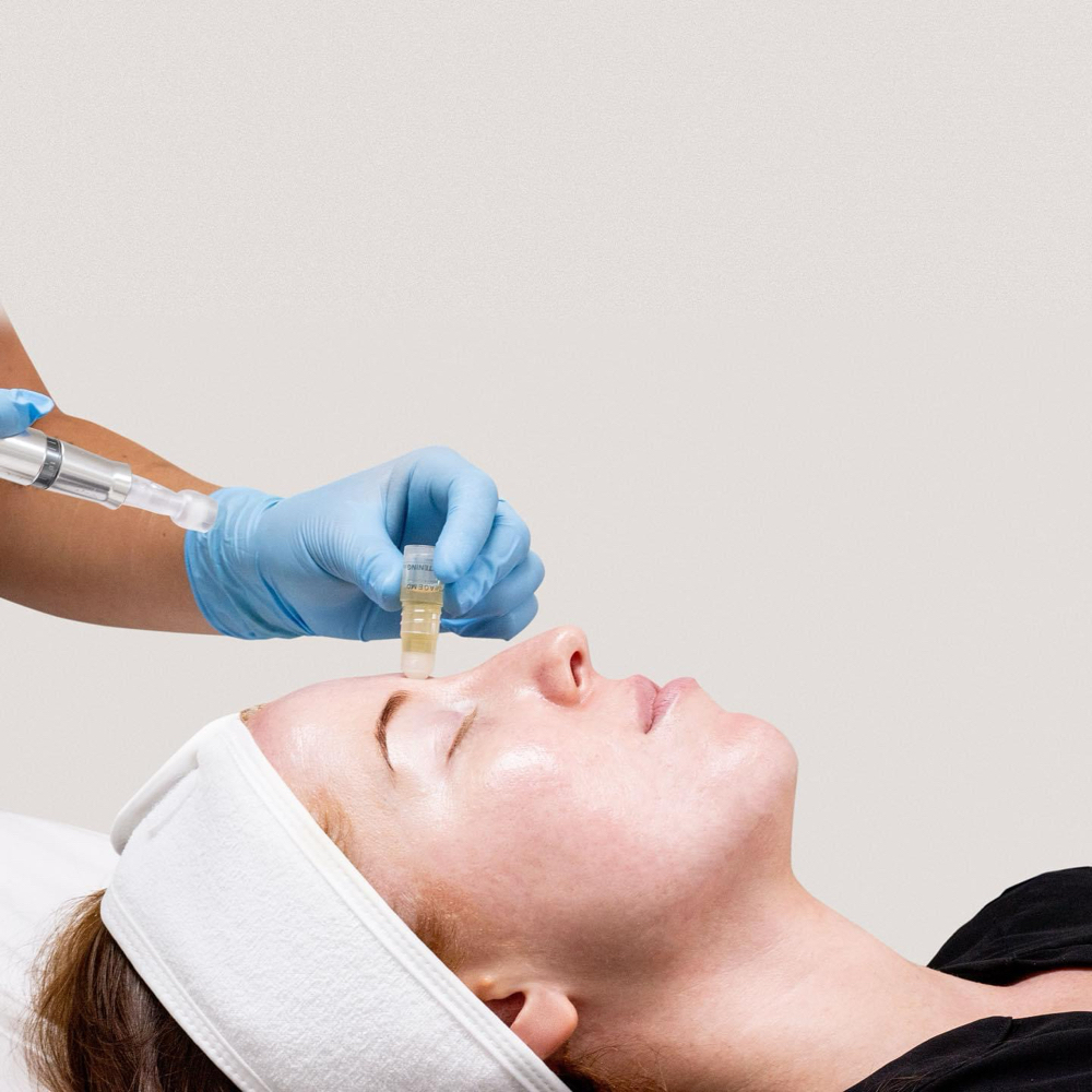 Nano Infusion Treatment Facial