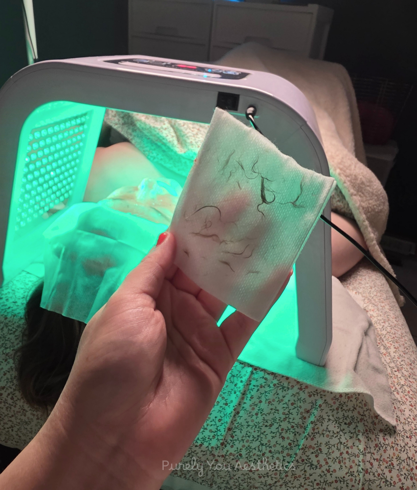 Derma Exfoliation Facial Addon