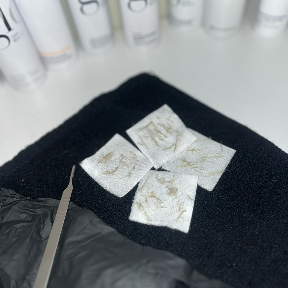 Epidermal Leveling