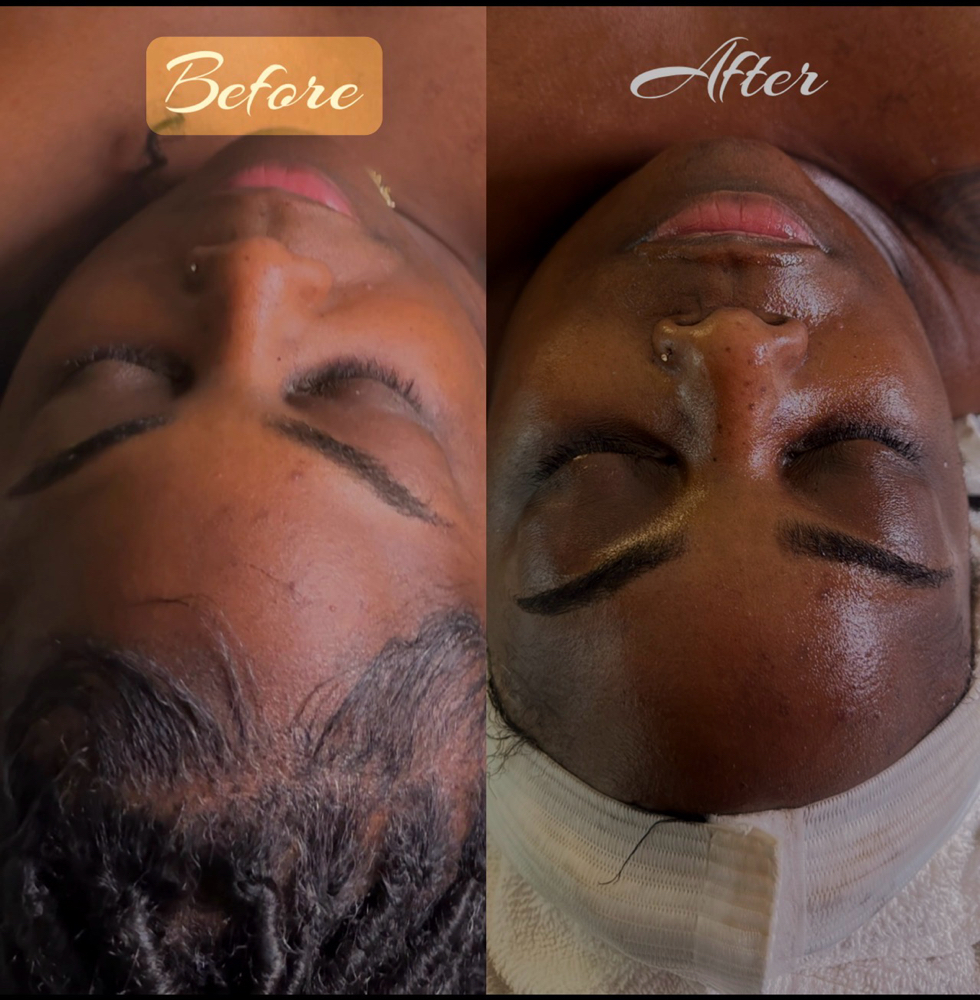 Classic Facial at A’Nicole Beauty Bar in Mesquite, TX