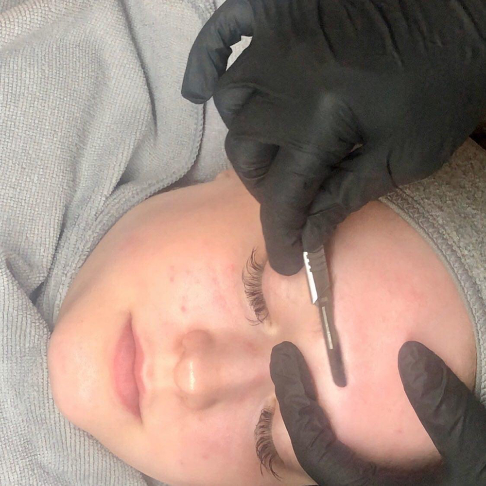 Dermaplane Facial