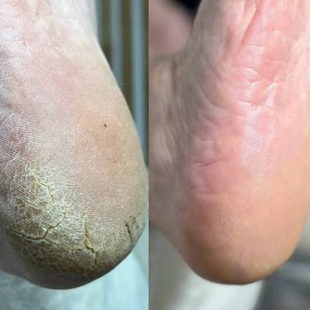 Advanced Russan Dry Pedicure at Nails by Stephanie Pediet in Allentown, PA