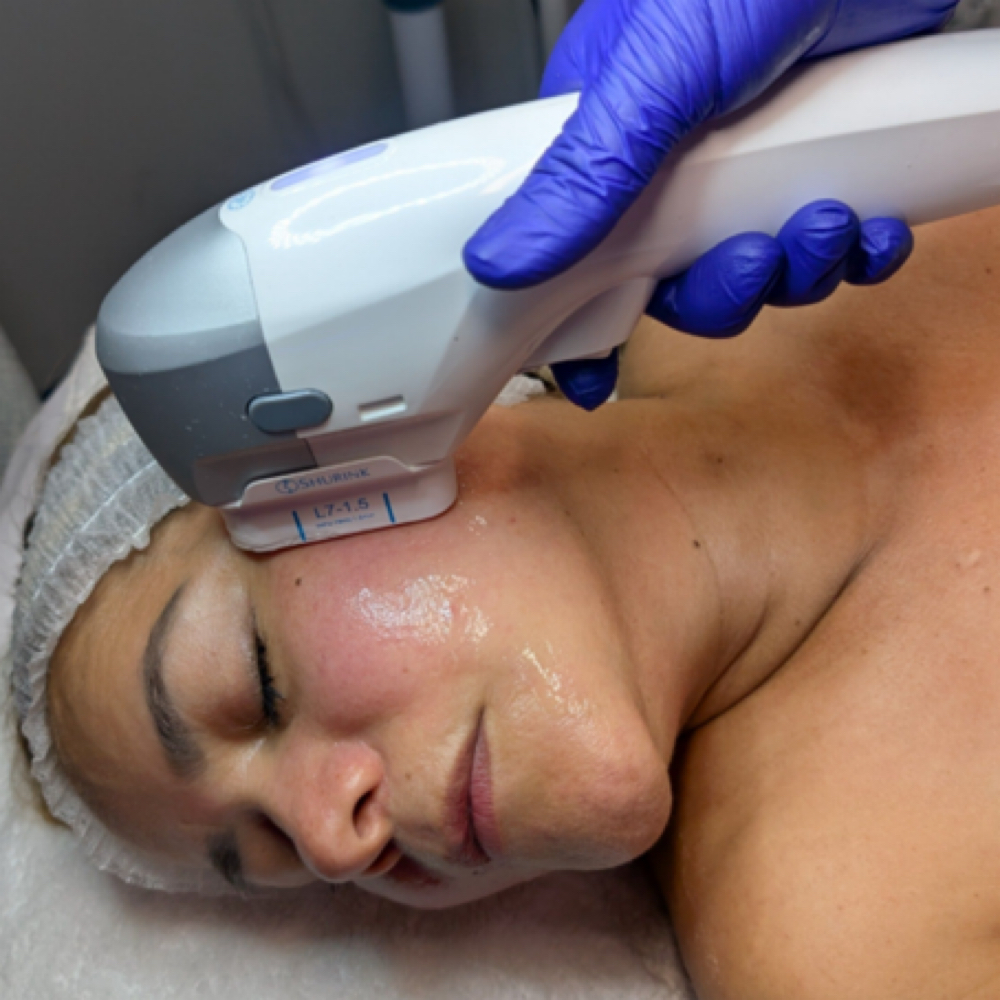 HIFU (High-Intensity Focused Ultrasound) at Nenusk Aesthetics in Long Island City, NY