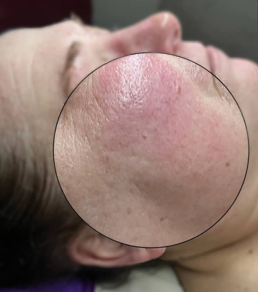 Korean Oxycure Facial