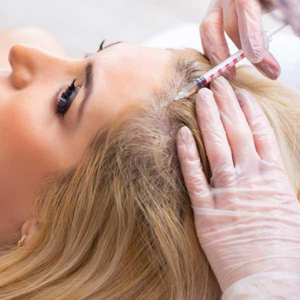 PRF Injections at Aesthetik Nurse Kat in Riverside, CA