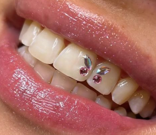 Tooth Gems