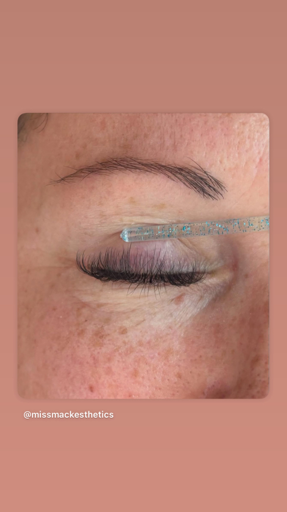 Natural Fill at Miss Mack Esthetics in Oklahoma City, OK