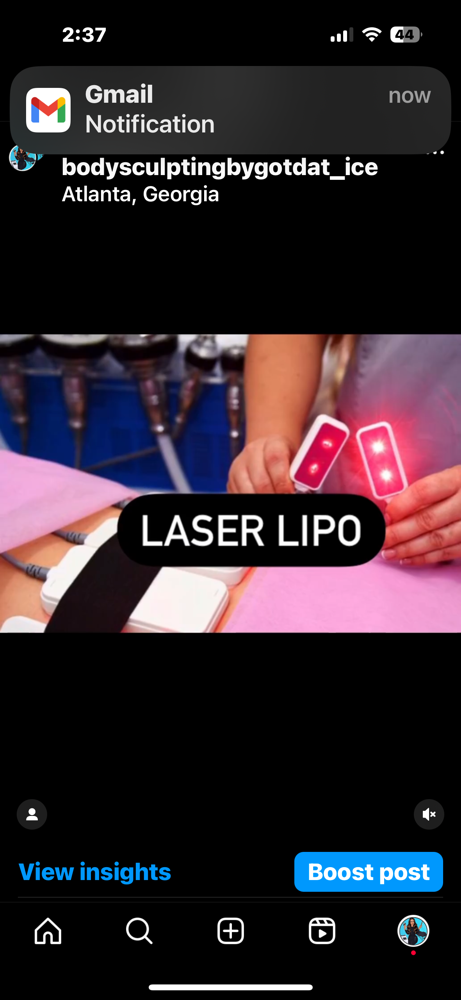 Laser Lipo