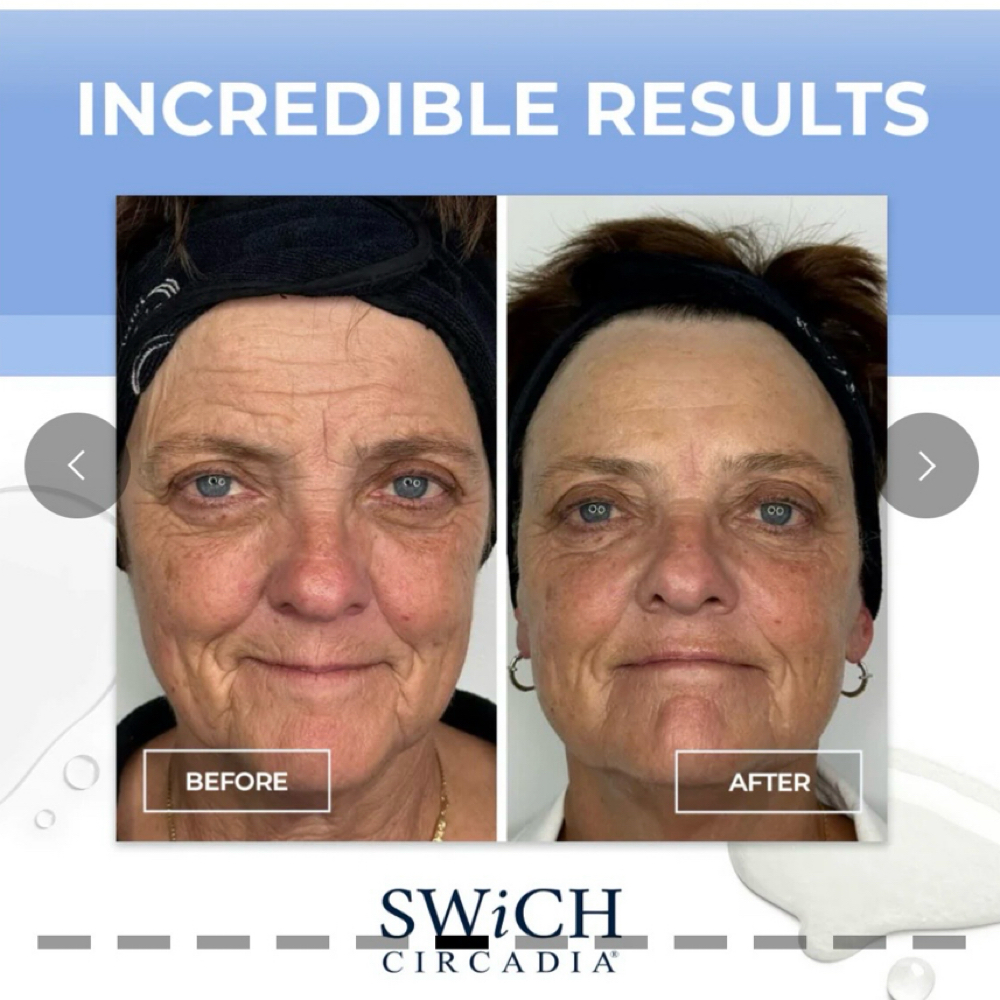 Swich Rejuvinating Facial at Skin Theory-Katie in Perry, FL