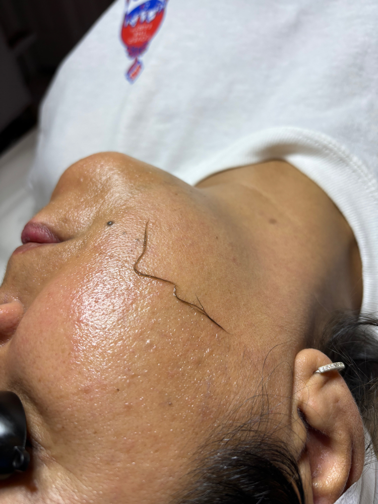 Dermaplane Facial