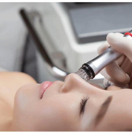 Korean Aqua Peel at O Beauty Services