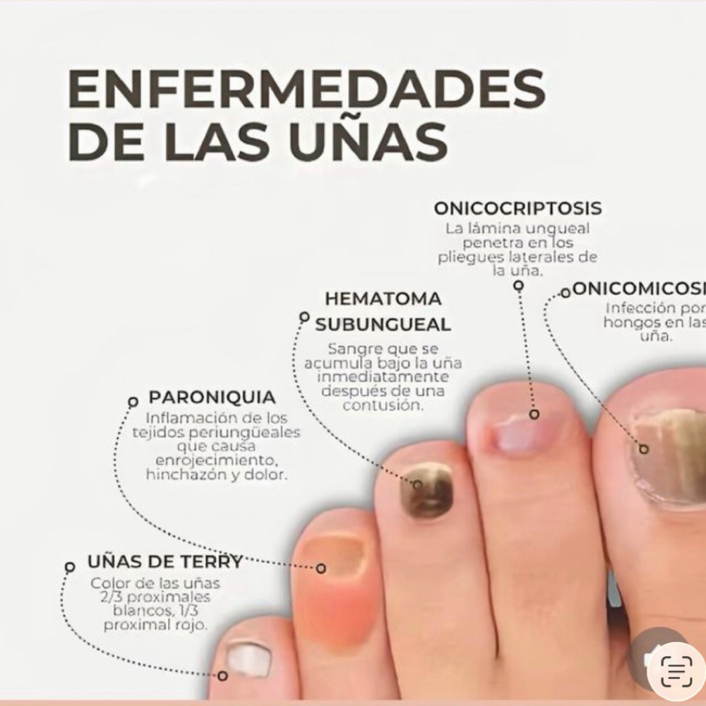 Basic Combined Chiropody Treatment at Dream Nails By Katterine in Corona, NY