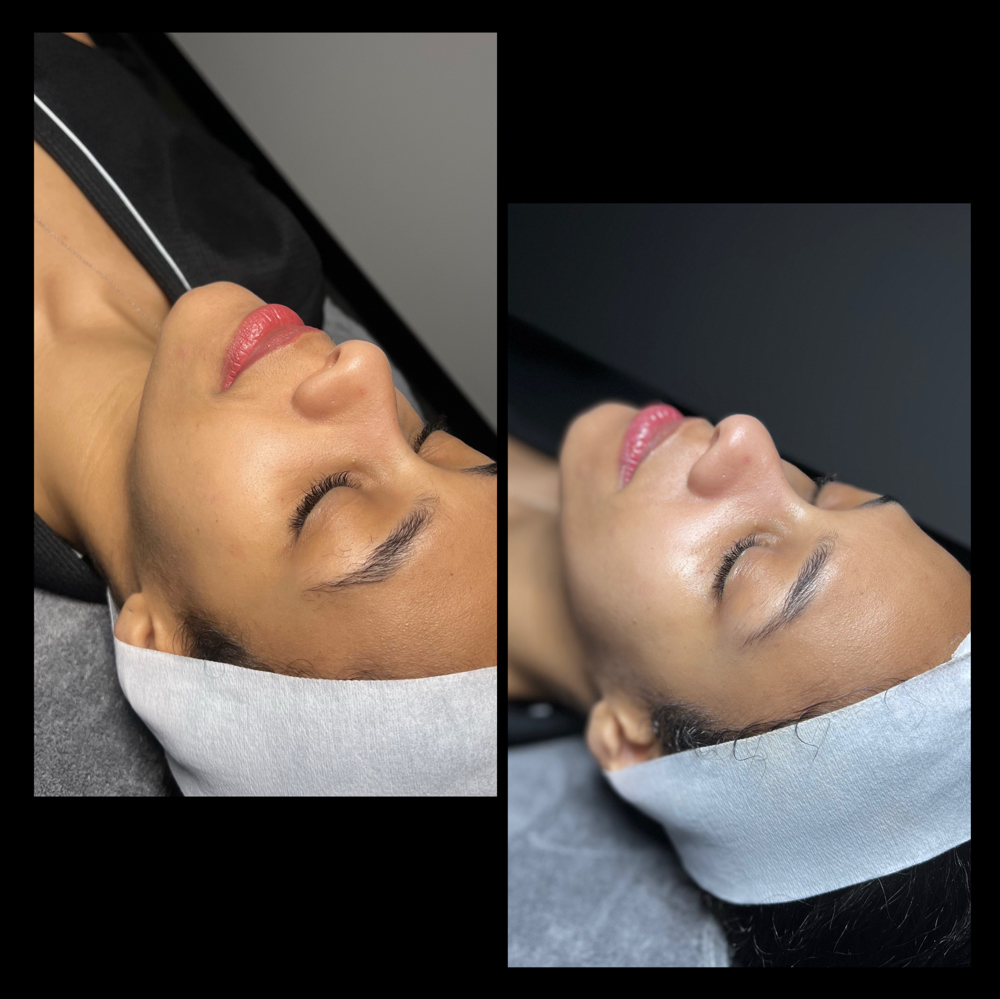 All Inclusive Dermaplaning Facial