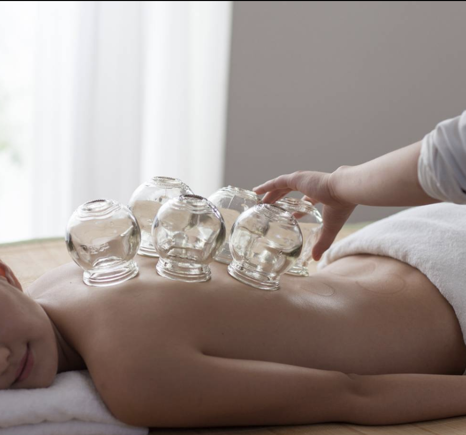 Cupping Therapy - Back