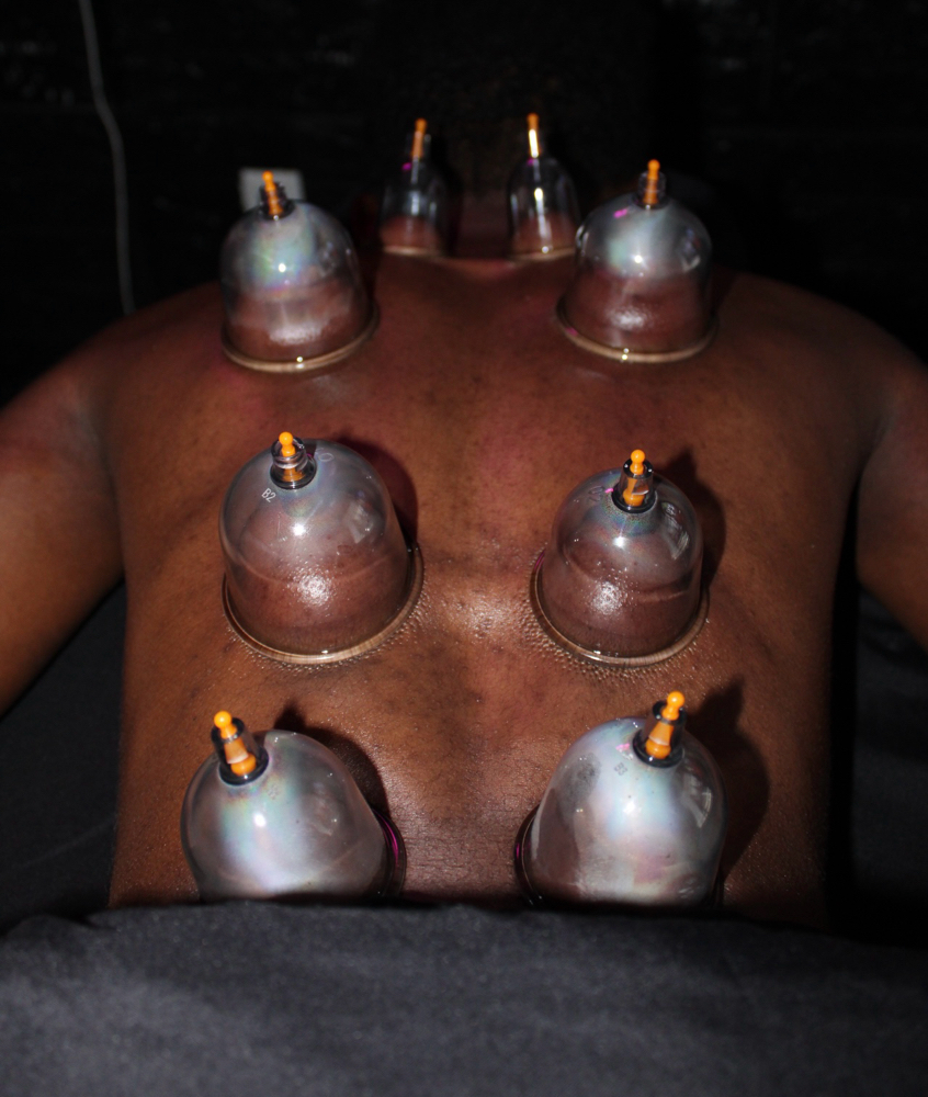 Cupping (ADD ON) at The Ky Effect in Pensacola, FL