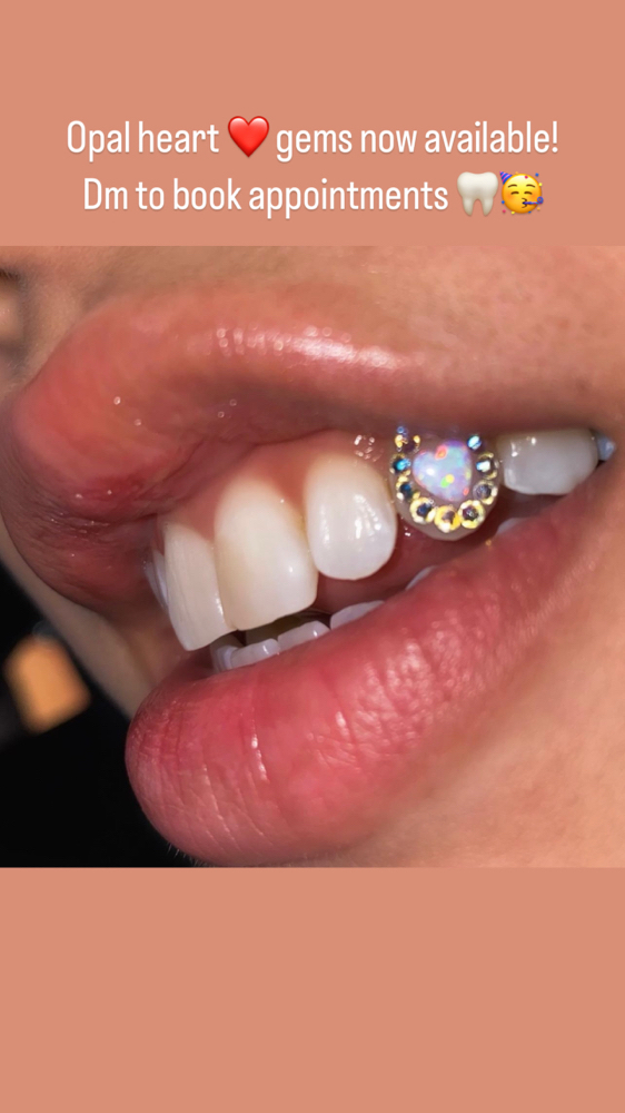 Opal Tooth Gem
