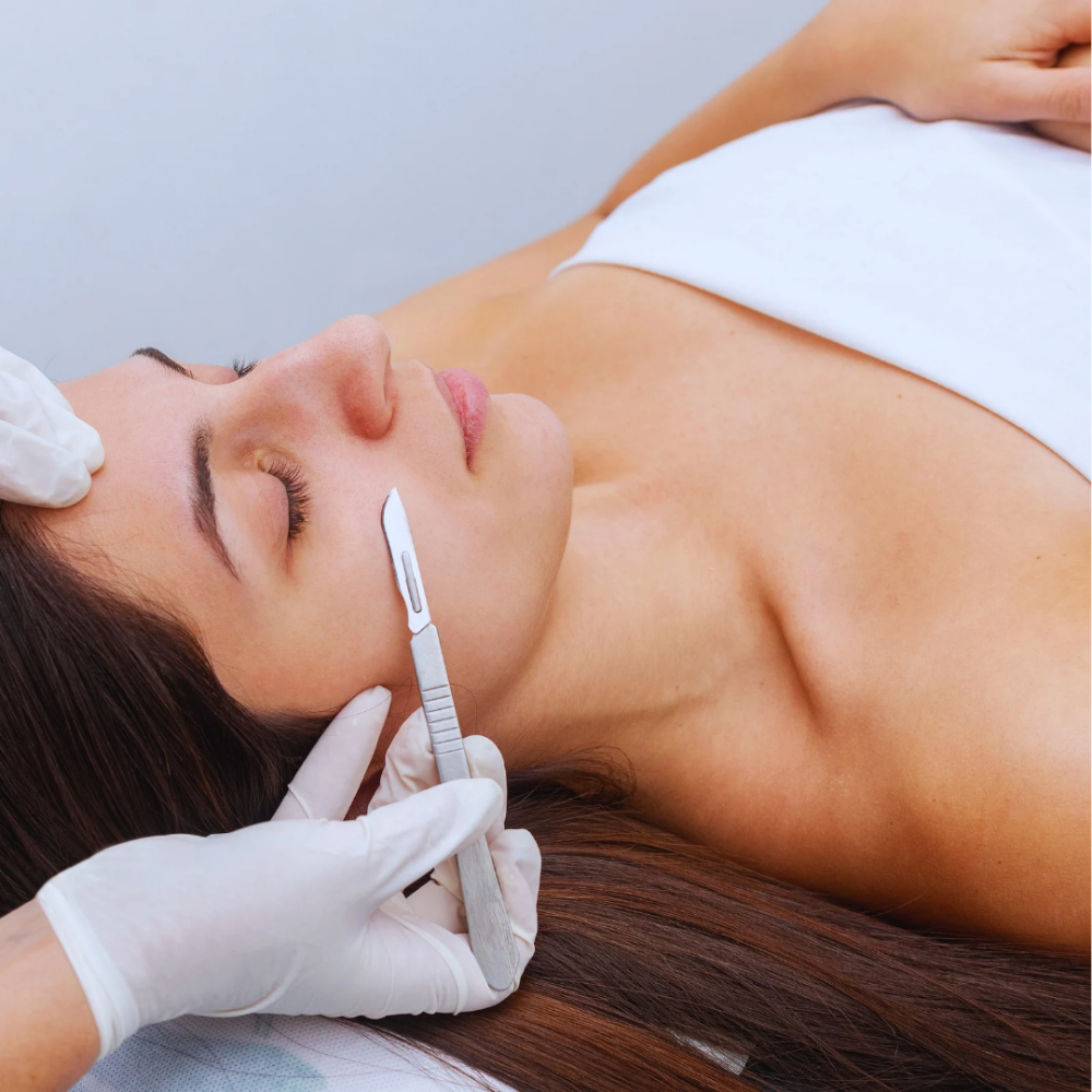 Dermaplaning