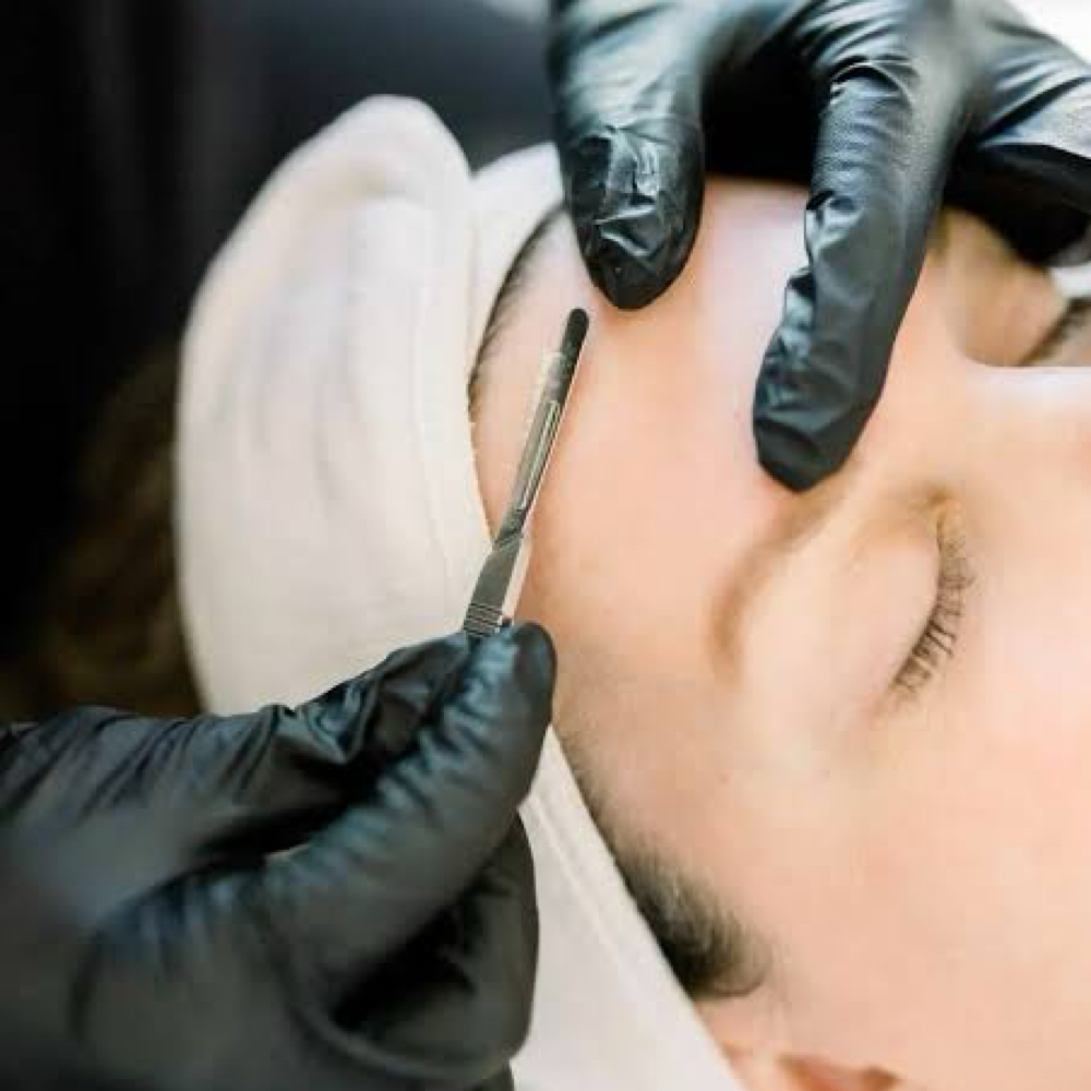 Dermaplane at Killer Vanity in Warrenton, VA
