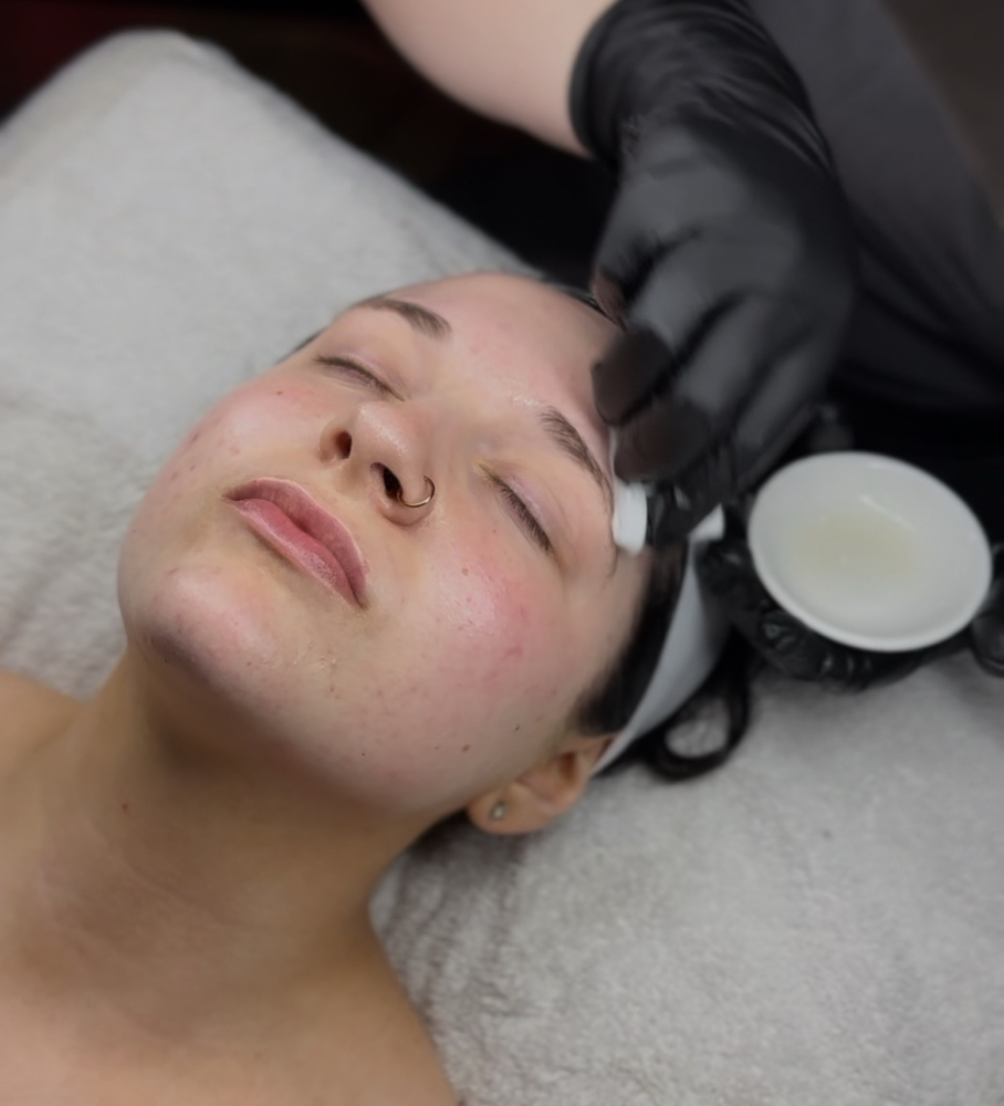 Pigment Lift Peel