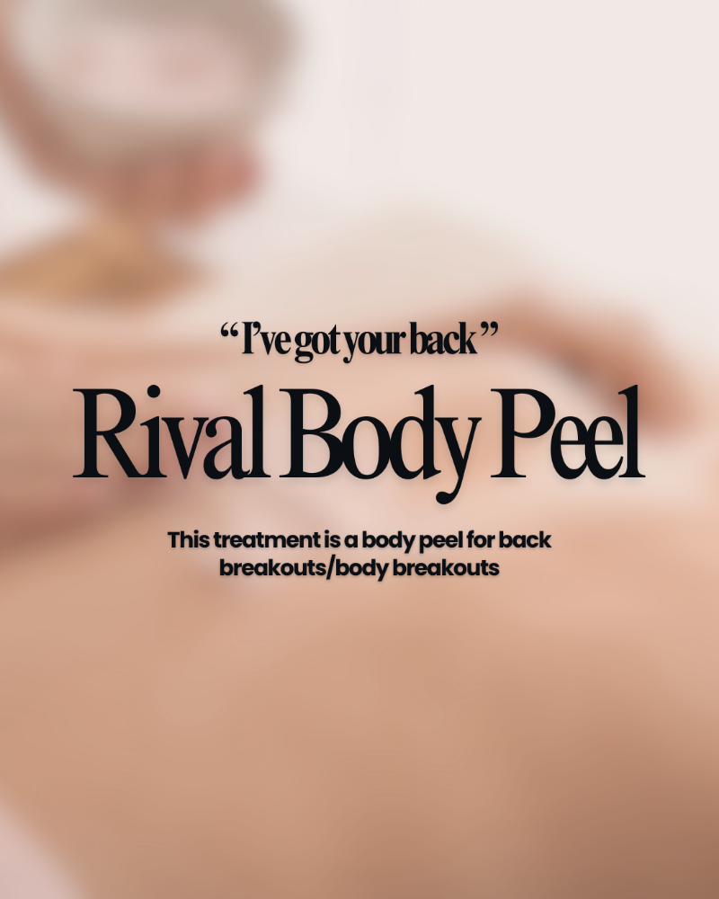 Rival Body Peel