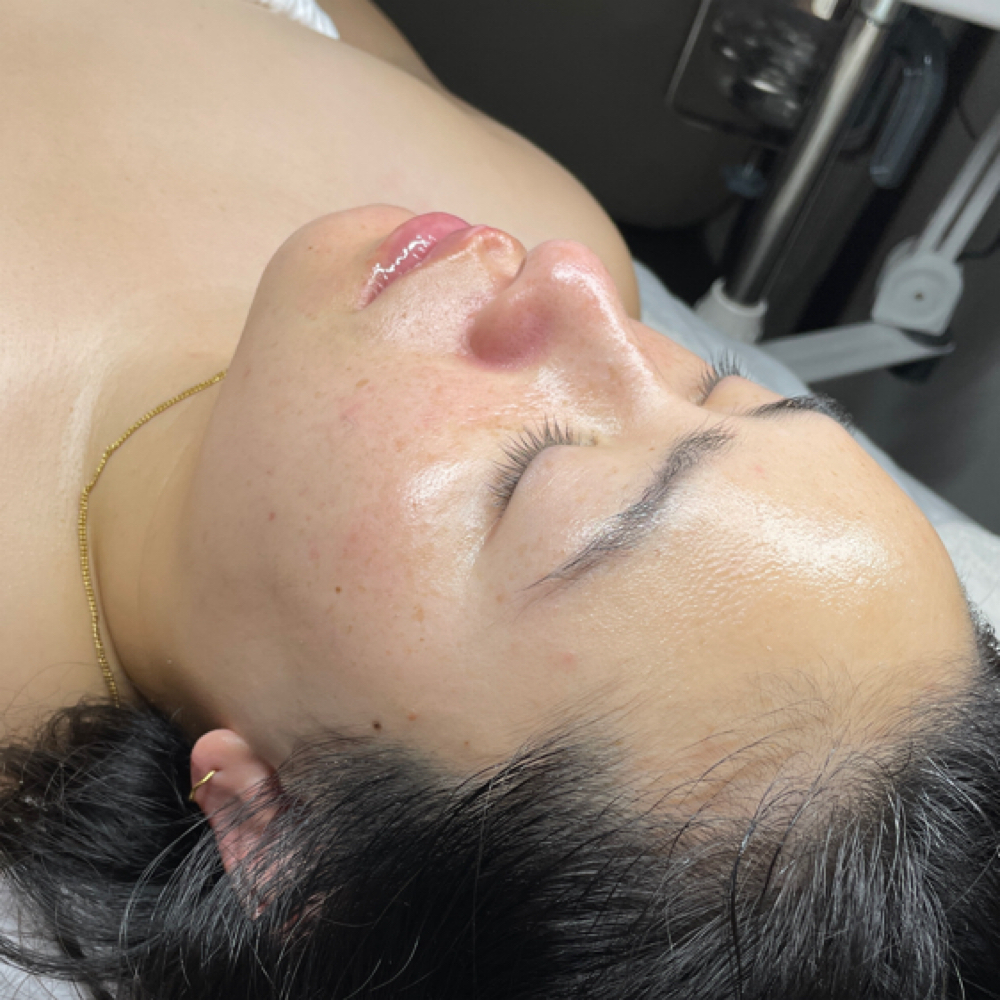 Glass Skin Facial at Soulestial in Daly City, CA