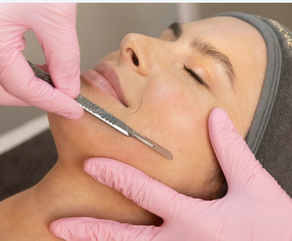 Dermaplaning add-on at Estetica Venice