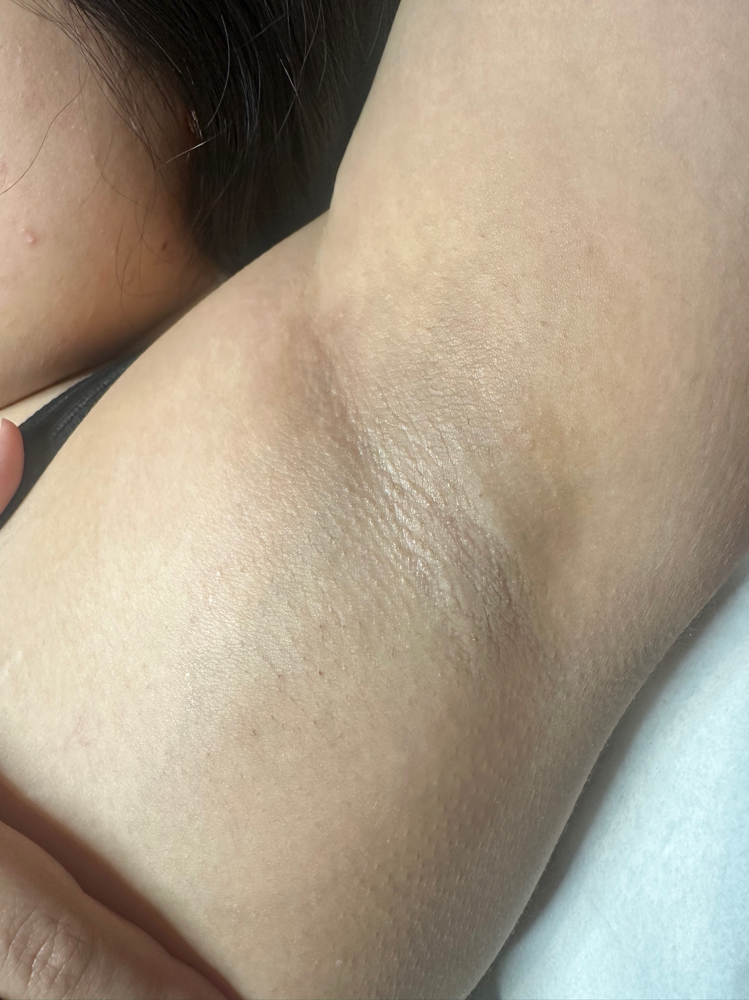 Underarm Wax