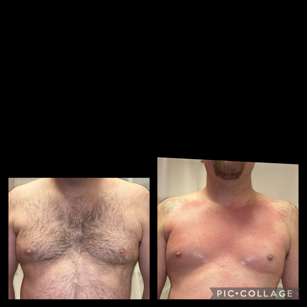 Chest