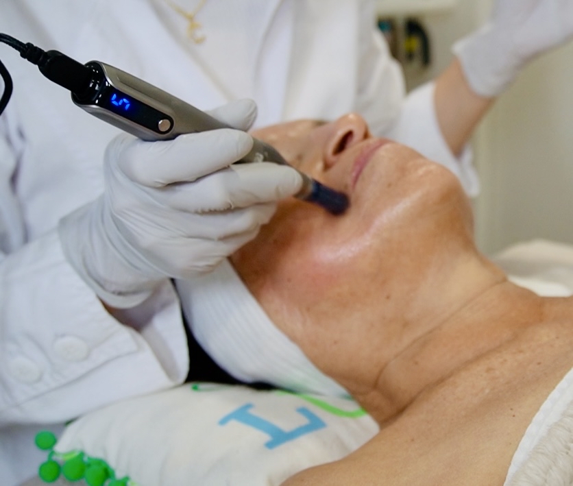 Cell Renewal / Microneedling