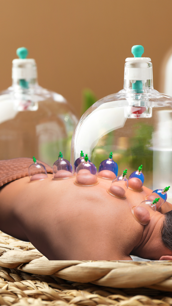 Cupping Add On