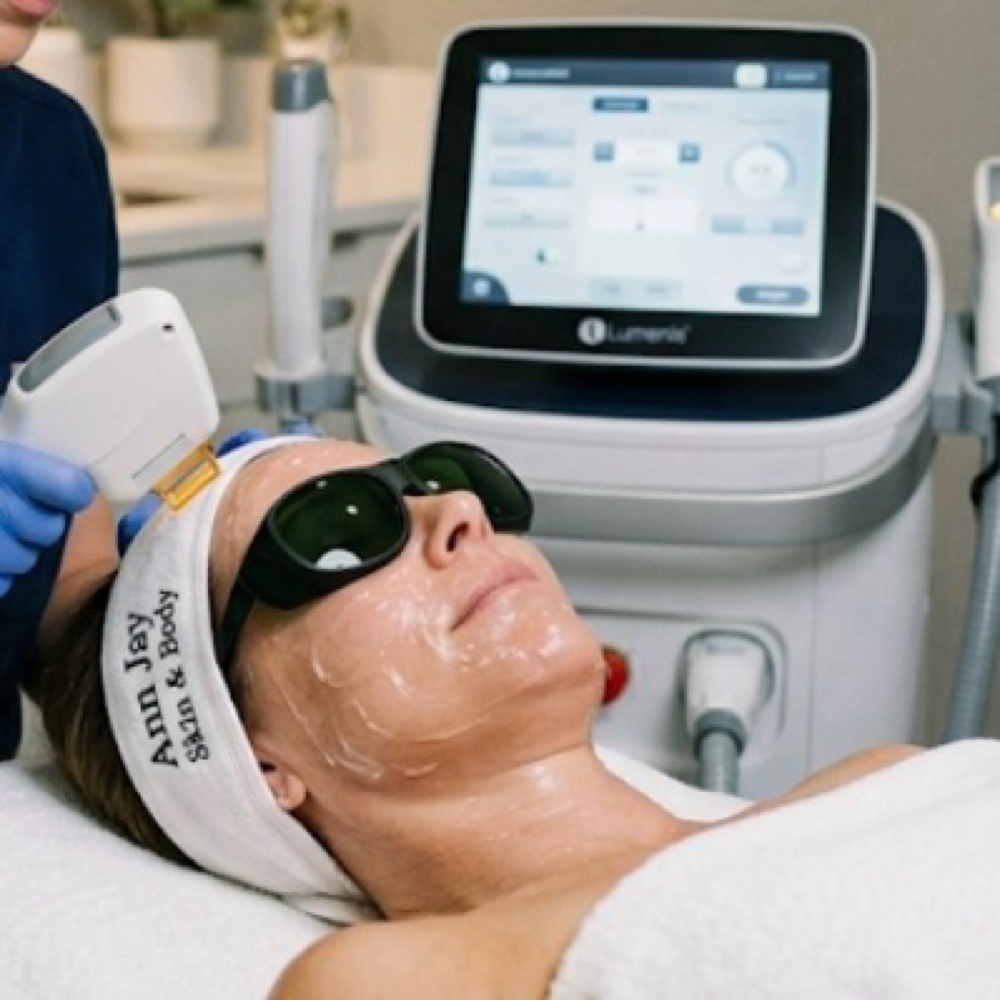 360 Transformation Treatmet at Ann Jay Skin & Body in Clifton, NJ