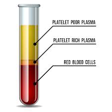 PRP at Susan Albright FNP in Grants Pass, OR