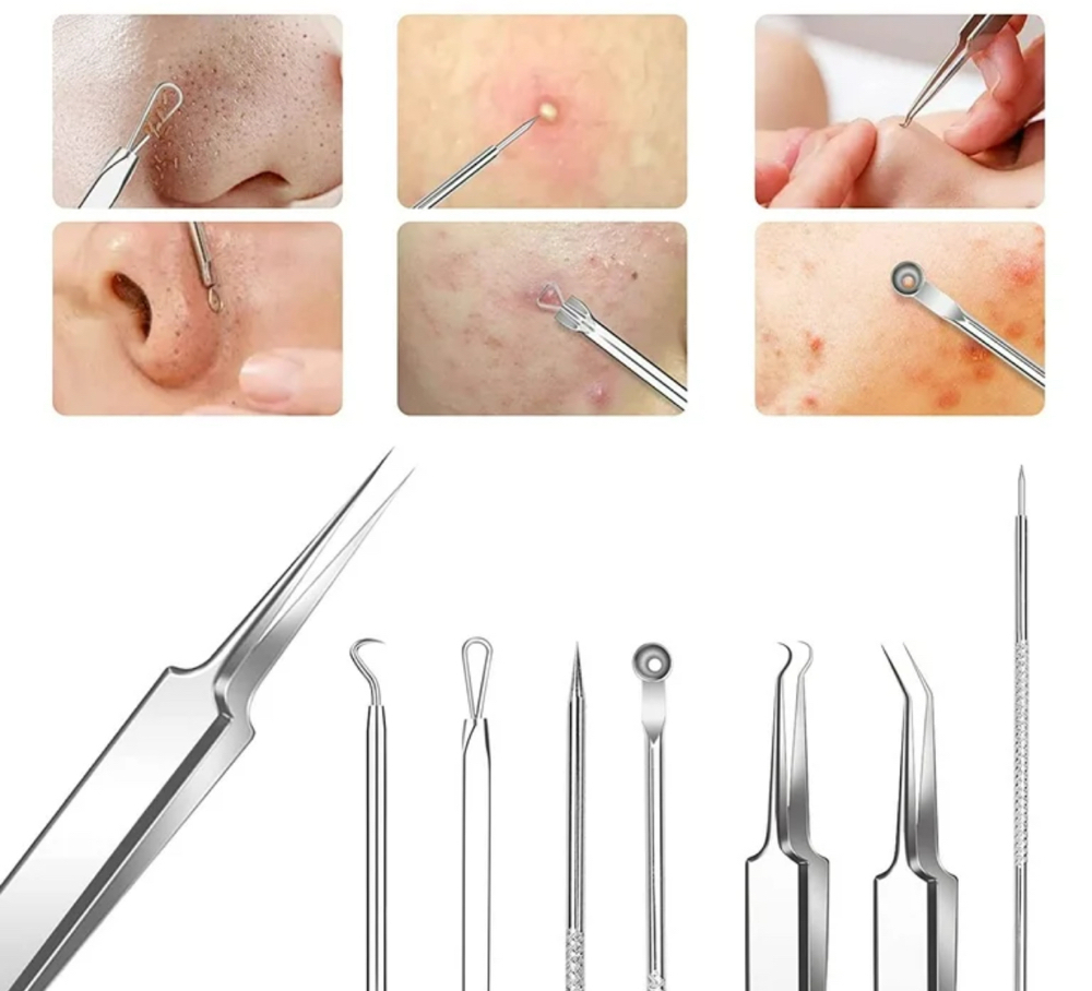 Extractions (ADD ON)